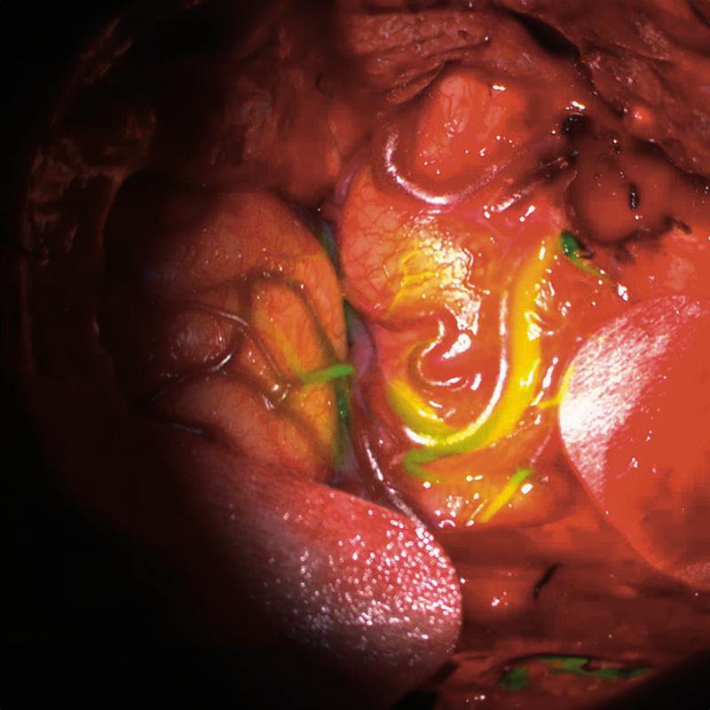 Операционная система для нейрохирургии ZEISS KINEVO 900